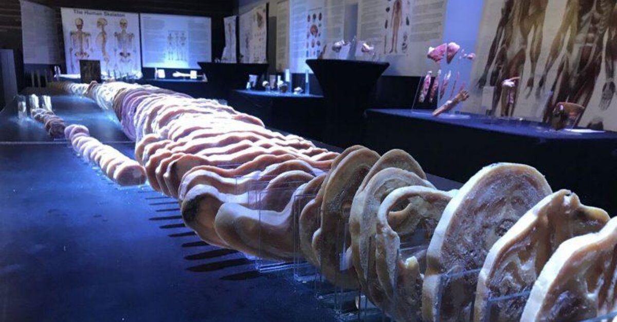 Ausstellung: Echte menschliche Körper